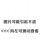 【手足外科】揪心！2岁宝宝不慎断指，所幸...
