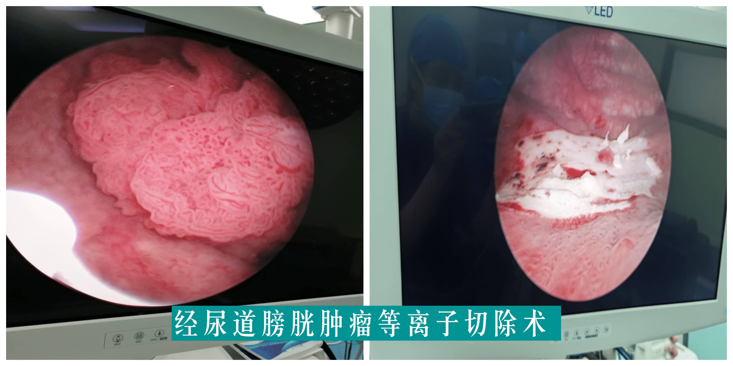 【福德专科】泌尿肾病中心