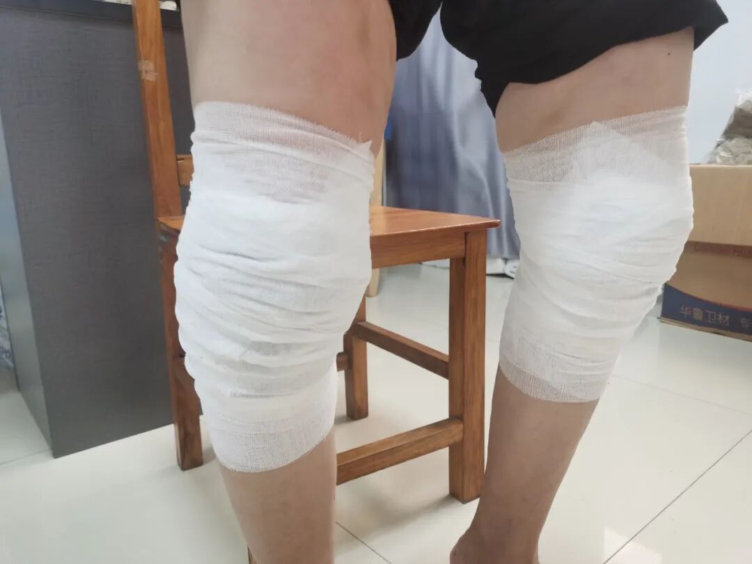 【福德康复】无痛疗愈新选择——中药外敷