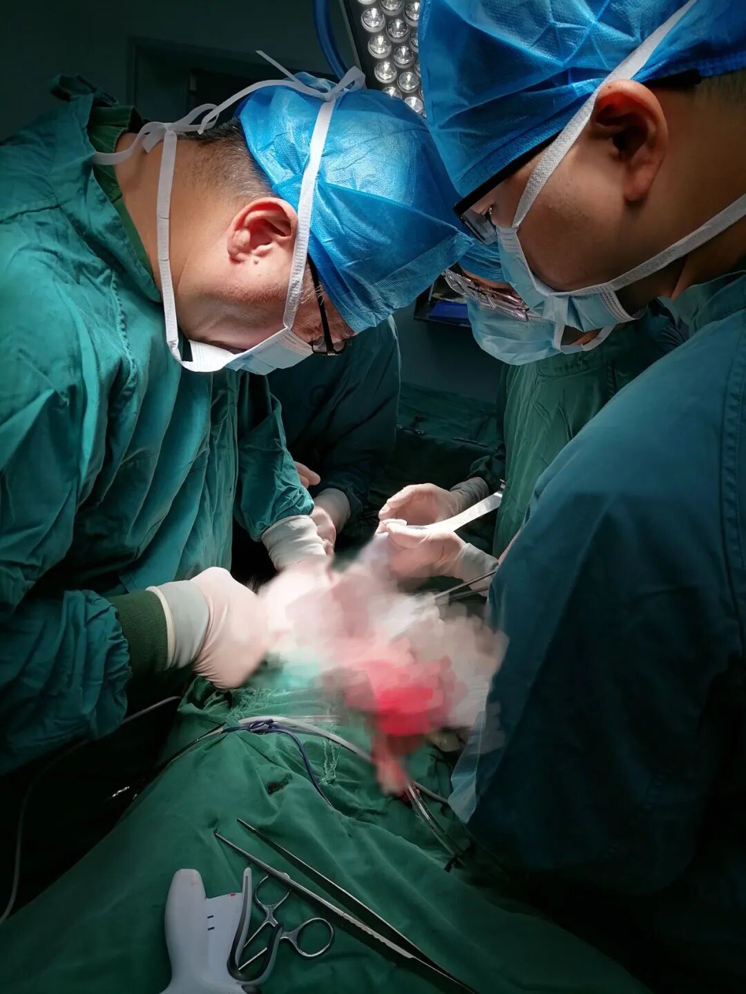 莆田福德医院泌尿肾病科成功救治气肿性肾盂肾炎重症感染患者